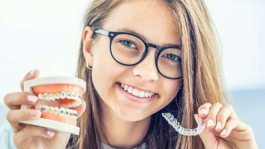Are Clear Aligners Really as Effective as Traditional Braces